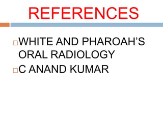 REFERENCES
WHITE AND PHAROAH’S
ORAL RADIOLOGY
C ANAND KUMAR
 