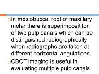 In mesiobuccal root of maxillary
molar there is superimposititon
of two pulp canals which can be
distinguished radiographically
when radiographs are taken at
different horizontal angulations.
CBCT imaging is useful in
evaluating multiple pulp canals
 