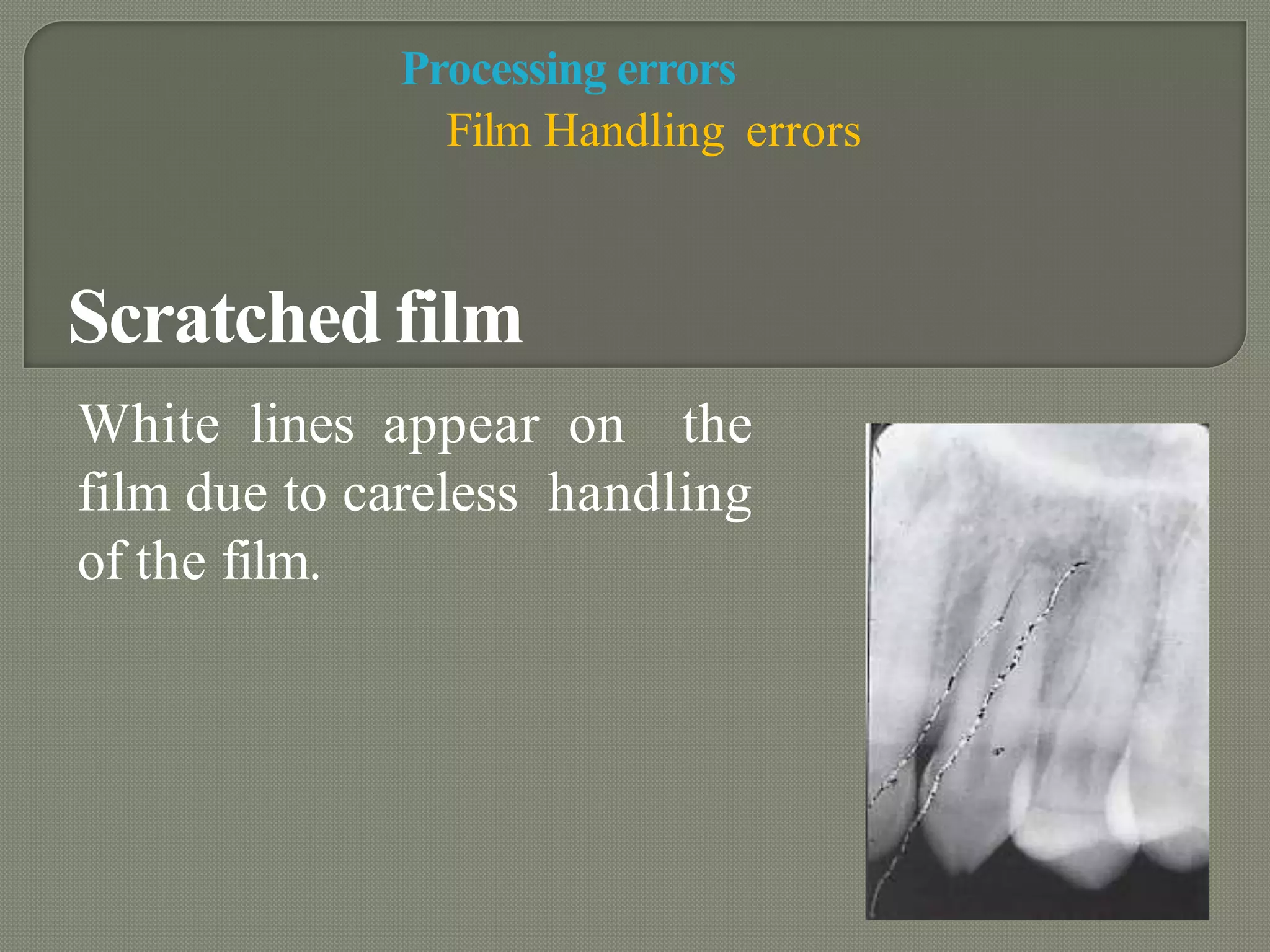 RADIOGRAPHIC ARTIFACTS | PPTX