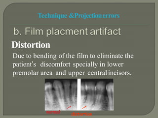 RADIOGRAPHIC ARTIFACTS | PPTX