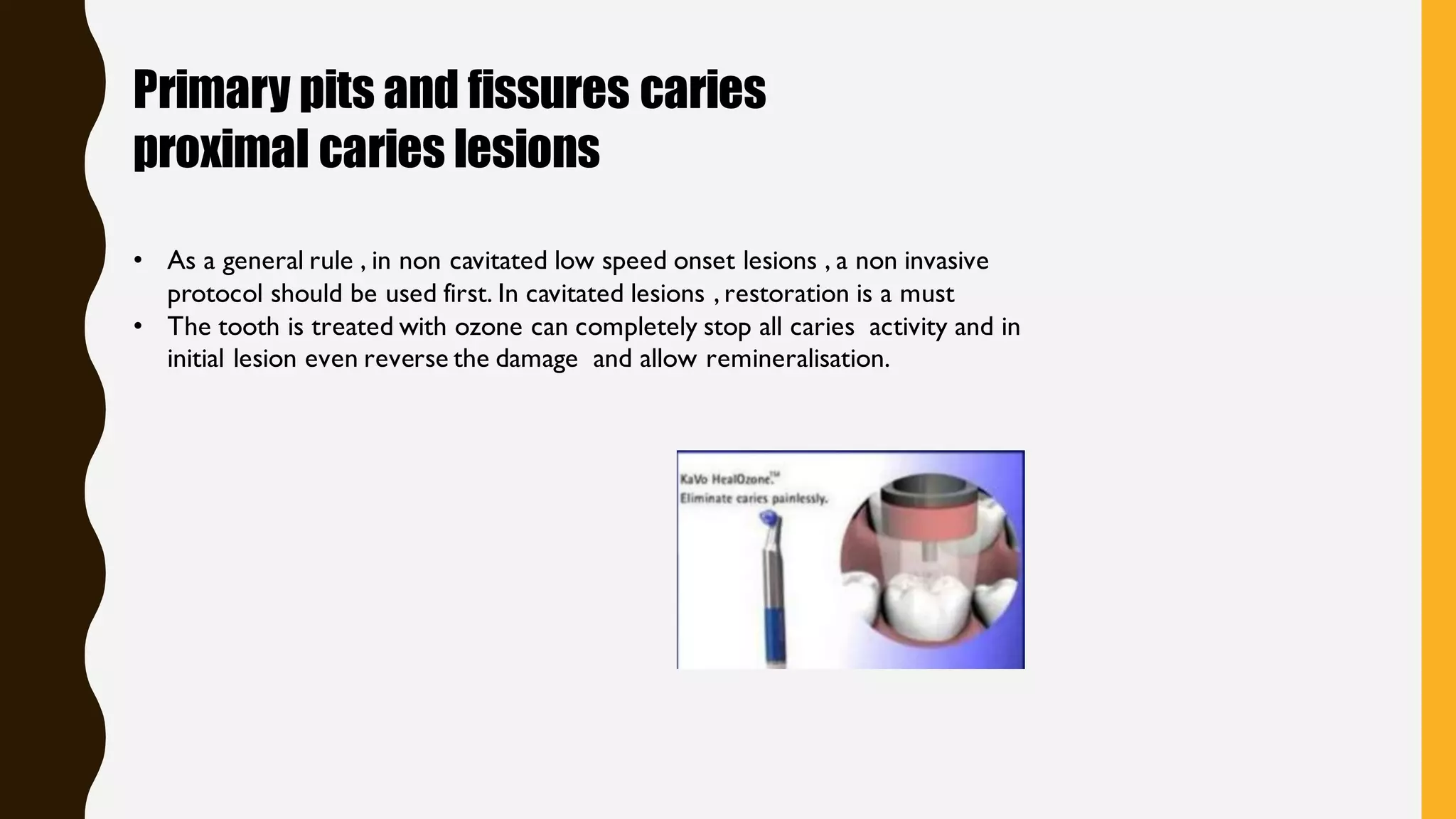 ozone therapy in dentistry