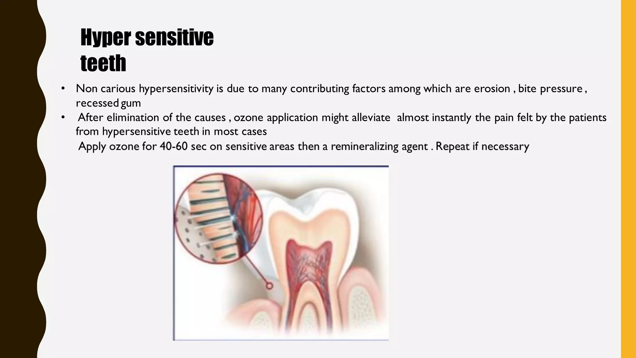 ozone therapy in dentistry