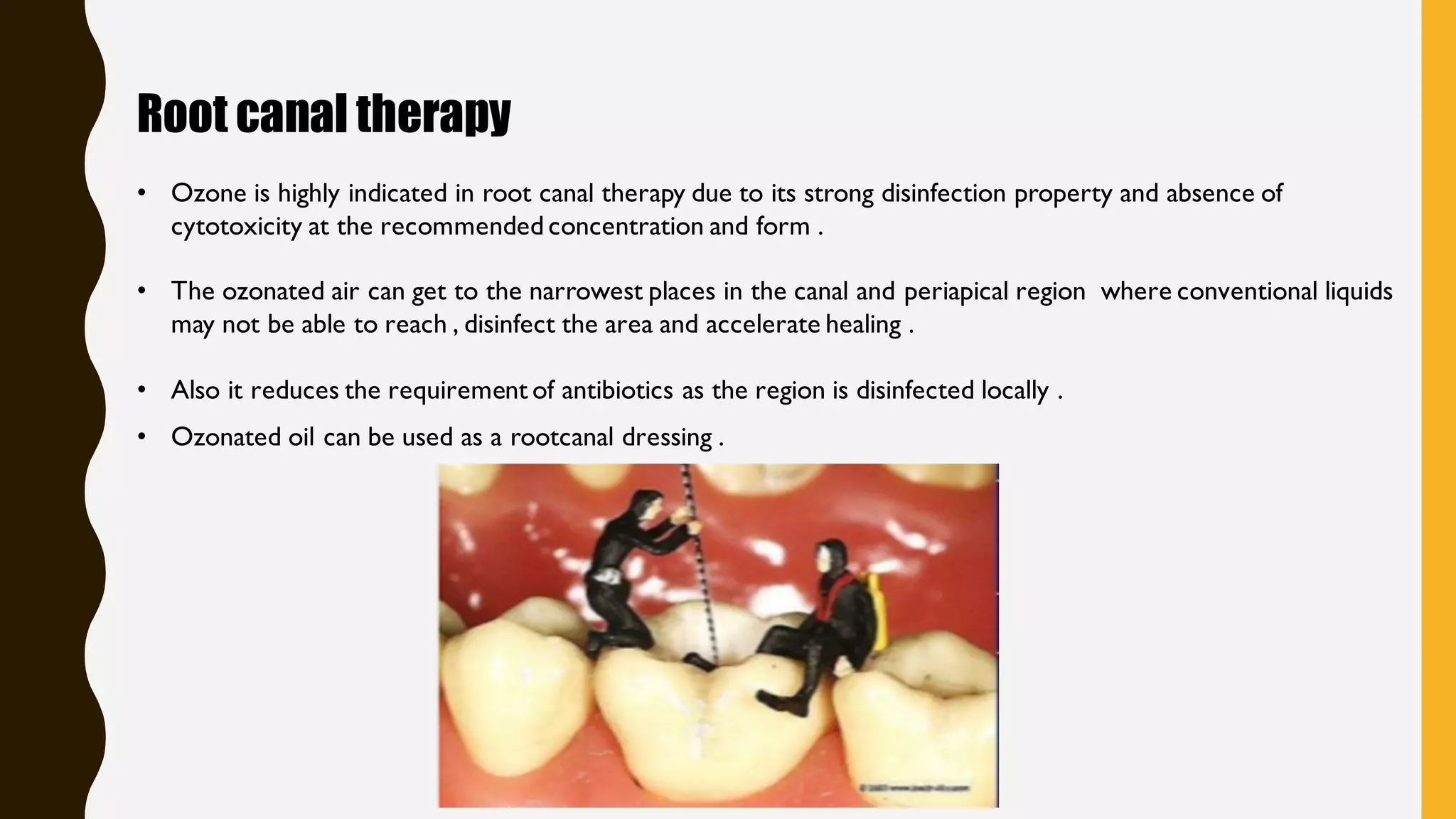 ozone therapy in dentistry