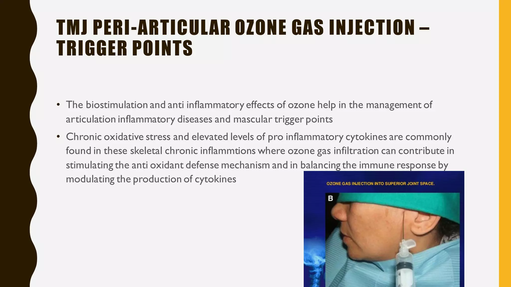 ozone therapy in dentistry