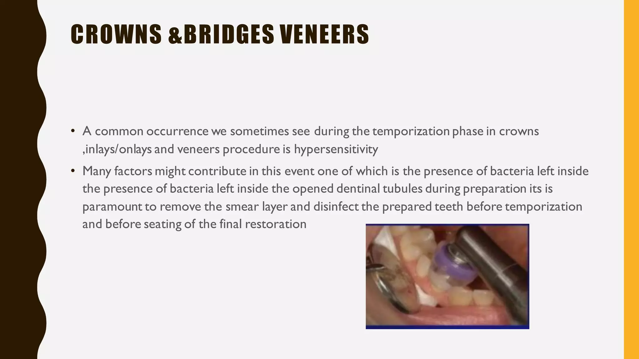 ozone therapy in dentistry