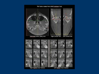 Imaging of tmj in dental radiography and advanced technologies in ...