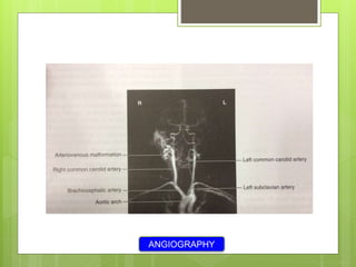 ANGIOGRAPHY
 