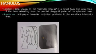 OMR_PRESENTATION[1] - Read-Only (2).pdf