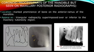 OMR_PRESENTATION[1] - Read-Only (2).pdf
