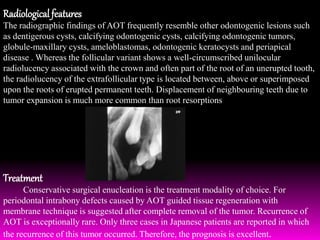 Aot Radiograph Differential Diagnosis Of Maxillary Sinus Pathology | PPTX