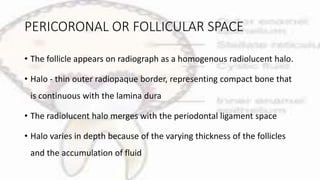 PERICORONAL OR FOLLICULAR SPACE
• The follicle appears on radiograph as a homogenous radiolucent halo.
• Halo - thin outer radiopaque border, representing compact bone that
is continuous with the lamina dura
• The radiolucent halo merges with the periodontal ligament space
• Halo varies in depth because of the varying thickness of the follicles
and the accumulation of fluid
 