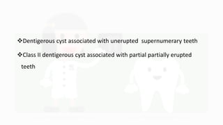 Dentigerous cyst associated with unerupted supernumerary teeth
Class II dentigerous cyst associated with partial partially erupted
teeth
 