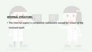 INTERNAL STRUCTURE:
• The internal aspect is completely radiolucent except for crown of the
involved tooth
 
