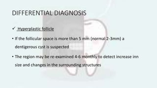 DIFFERENTIAL DIAGNOSIS
 Hyperplastic follicle
• If the follicular space is more than 5 mm (normal 2-3mm) a
dentigerous cyst is suspected
• The region may be re-examined 4-6 monthly to detect increase inn
size and changes in the surrounding structures
 