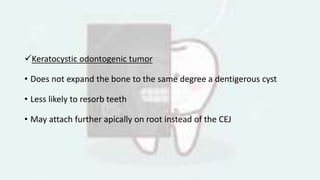 Keratocystic odontogenic tumor
• Does not expand the bone to the same degree a dentigerous cyst
• Less likely to resorb teeth
• May attach further apically on root instead of the CEJ
 