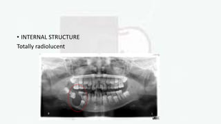 • INTERNAL STRUCTURE
Totally radiolucent
 