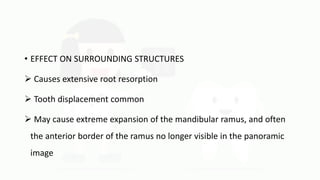 • EFFECT ON SURROUNDING STRUCTURES
 Causes extensive root resorption
 Tooth displacement common
 May cause extreme expansion of the mandibular ramus, and often
the anterior border of the ramus no longer visible in the panoramic
image
 