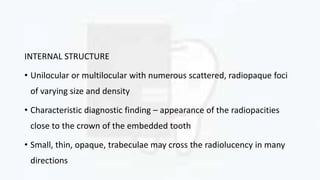 INTERNAL STRUCTURE
• Unilocular or multilocular with numerous scattered, radiopaque foci
of varying size and density
• Characteristic diagnostic finding – appearance of the radiopacities
close to the crown of the embedded tooth
• Small, thin, opaque, trabeculae may cross the radiolucency in many
directions
 