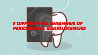 5 DIFFERENTIAL DIAGNOSIS OF
PERICORONAL RADIOLUCENCIES
 