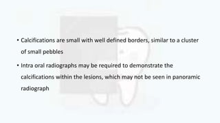 • Calcifications are small with well defined borders, similar to a cluster
of small pebbles
• Intra oral radiographs may be required to demonstrate the
calcifications within the lesions, which may not be seen in panoramic
radiograph
 