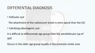 DIFFERENTIAL DIAGNOSIS
• Follicular cyst
The attachment of the radiolucent lesion is more apical than the CEJ
• Calcifying odontogenic cyst
It is difficult to differentiate age group from the extrafollicular typ of
AOT
Occurs in the older age group usually in the premolar-molar area
 