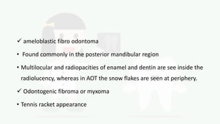  ameloblastic fibro odontoma
• Found commonly in the posterior mandibular region
• Multilocular and radiopacities of enamel and dentin are see inside the
radiolucency, whereas in AOT the snow flakes are seen at periphery.
 Odontogenic fibroma or myxoma
• Tennis racket appearance
 