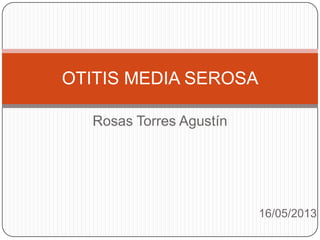Rosas Torres Agustín
16/05/2013
OTITIS MEDIA SEROSA
 