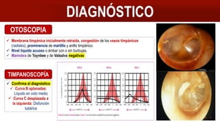 DIAGNÓSTICO
OTOSCOPIA
 Membrana timpánica inicialmente retraída, congestión de los vasos timpánicos
(radiales), prominencia de martillo y anillo timpánico.
 Nivel líquido acuoso o ámbar con o sin burbujas.
 Maniobra de Toynbee y de Valsalva negativas
TIMPANOSCOPÍA
 Confirma el diagnóstico
 Curva B aplanadas:
Líquido en oído medio
 Curva C desplazada a
la izquierda: Disfunción
tubárica
 