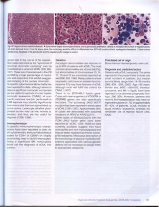 Clasificación de leucemias - OMS 2008