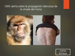 Carlos
Enrique
OMS alerta sobre la propagación silenciosa de
la viruela del mono
 
