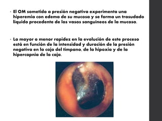 • El OM sometido a presión negativa experimenta una
hiperemia con edema de su mucosa y se forma un trasudado
líquido procedente de los vasos sanguíneos de la mucosa.
• La mayor o menor rapidez en la evolución de este proceso
está en función de la intensidad y duración de la presión
negativa en la caja del tímpano, de la hipoxia y de la
hipercapnia de la caja.
 