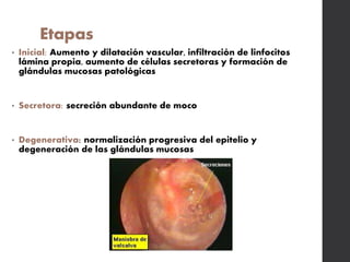 Etapas
• Inicial: Aumento y dilatación vascular, infiltración de linfocitos
lámina propia, aumento de células secretoras y formación de
glándulas mucosas patológicas
• Secretora: secreción abundante de moco
• Degenerativa: normalización progresiva del epitelio y
degeneración de las glándulas mucosas
 