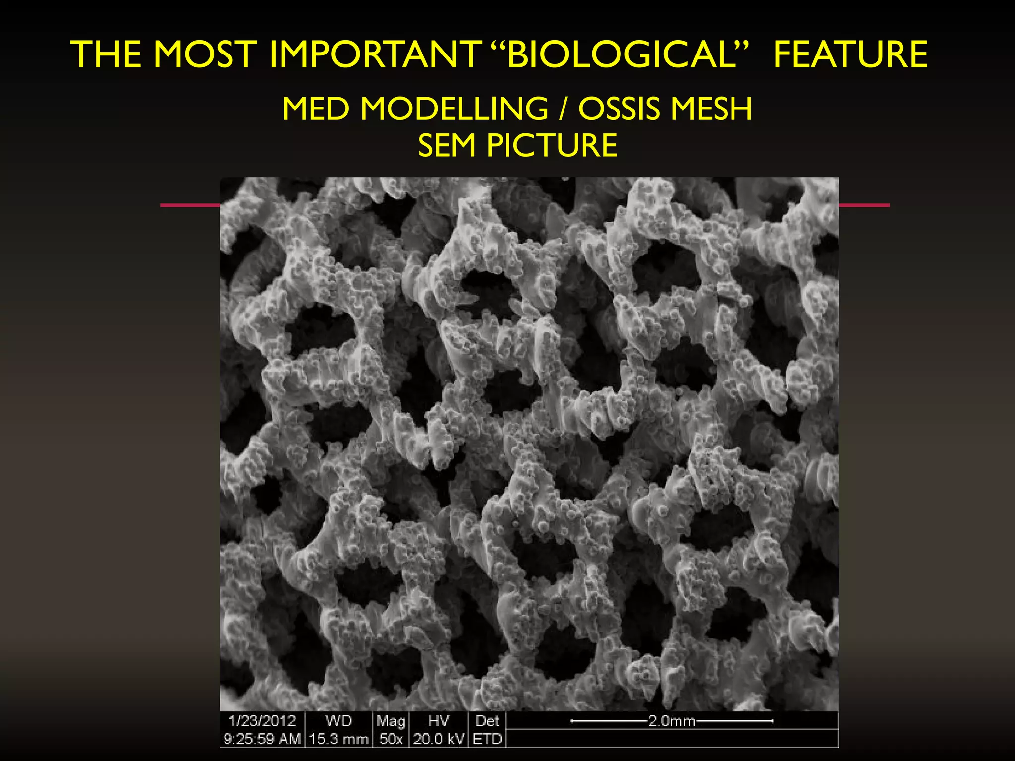 MED MODELLING / OSSIS MESH
SEM PICTURE
THE MOST IMPORTANT “BIOLOGICAL” FEATURE
 
