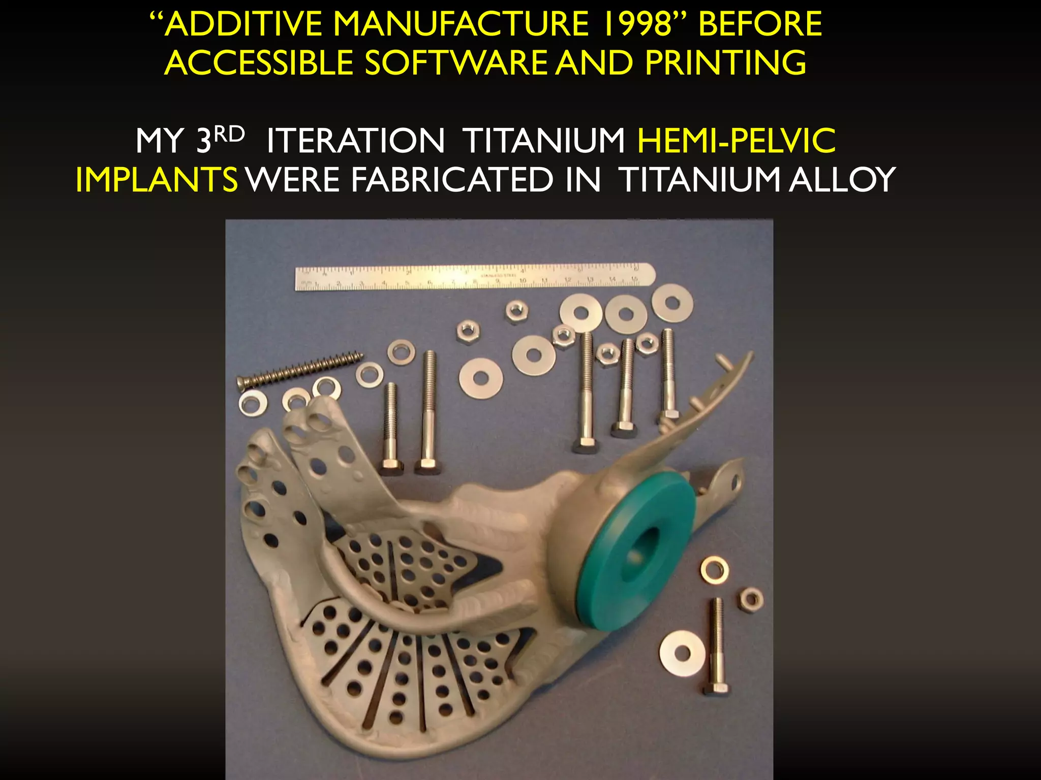 “ADDITIVE MANUFACTURE 1998” BEFORE
ACCESSIBLE SOFTWARE AND PRINTING
MY 3RD ITERATION TITANIUM HEMI-PELVIC
IMPLANTS WERE FABRICATED IN TITANIUM ALLOY
 