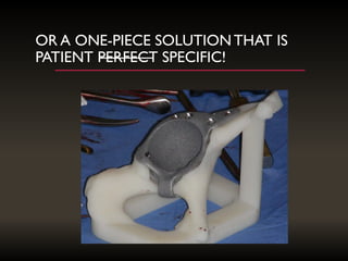OR A ONE-PIECE SOLUTIONTHAT IS
PATIENT PERFECT SPECIFIC!
 