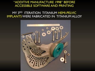 “ADDITIVE MANUFACTURE 1998” BEFORE
ACCESSIBLE SOFTWARE AND PRINTING
MY 3RD ITERATION TITANIUM HEMI-PELVIC
IMPLANTS WERE FABRICATED IN TITANIUM ALLOY
 