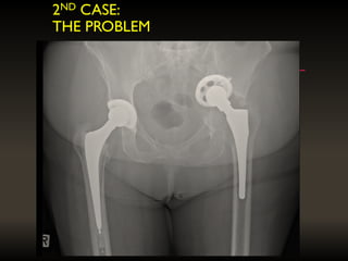 2ND CASE:
THE PROBLEM
 