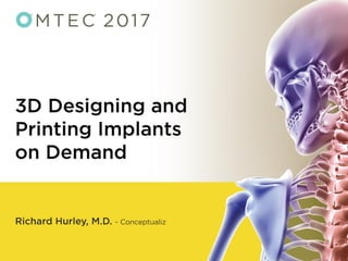 3D Designing and Printing Implants on Demand - OMTEC 2017