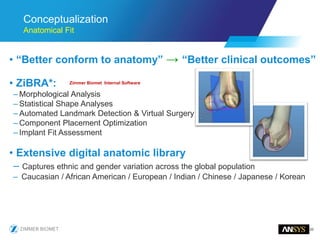 20
Conceptualization
Anatomical Fit
• “Better conform to anatomy” → “Better clinical outcomes”
• ZiBRA*:
– Morphological Analysis
– Statistical Shape Analyses
– Automated Landmark Detection & Virtual Surgery
– Component Placement Optimization
– Implant Fit Assessment
• Extensive digital anatomic library
– Captures ethnic and gender variation across the global population
– Caucasian / African American / European / Indian / Chinese / Japanese / Korean
Zimmer Biomet Internal Software
 