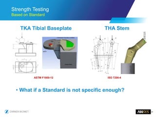 24
Strength Testing
Based on Standard
TKA Tibial Baseplate THA Stem
• What if a Standard is not specific enough?
ASTM F1800-12 ISO 7206-4
 