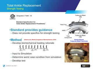 25
Total Ankle Replacement
Strength Testing
•Standard provides guidance
– Does not provide specifics for strength testing
•Method
– Develop biomechanical loading rationale
– Input to Simulation
– Determine worst case condition from simulation
– Develop test
Trabecular Metal
(TM)
Trabecular Metal
(TM)
Talar
Component
Tibial Tray
HXPE
Zimmer Biomet
Trabecular Metal Total Ankle
Dharia et al, World Congress of Biomechanics, 2014
Talus
Tibia
 