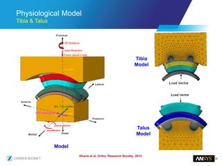 28
Physiological Model
Tibia & Talus
Dharia et al, Ortho. Research Society, 2013
Model
Tibia
Model
Talus
Model
 