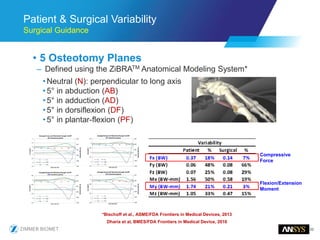 33
Patient & Surgical Variability
Surgical Guidance
• 5 Osteotomy Planes
– Defined using the ZiBRATM Anatomical Modeling System*
•Neutral (N): perpendicular to long axis
•5° in abduction (AB)
•5° in adduction (AD)
•5° in dorsiflexion (DF)
•5° in plantar-flexion (PF)
Dharia et al, BMES/FDA Frontiers in Medical Device, 2016
*Bischoff et al., ASME/FDA Frontiers in Medical Devices, 2013
Compressive
Force
Flexion/Extension
Moment
 