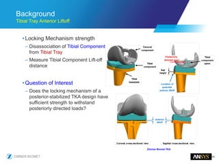 49
Background
Tibial Tray Anterior Liftoff
•Locking Mechanism strength
– Disassociation of Tibial Component
from Tibial Tray
– Measure Tibial Component Lift-off
distance
•Question of Interest
– Does the locking mechanism of a
posterior-stabilized TKA design have
sufficient strength to withstand
posteriorly directed loads?
Zimmer Biomet TKA
 