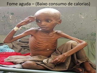 Fome aguda – (Baixo consumo de calorias)
 