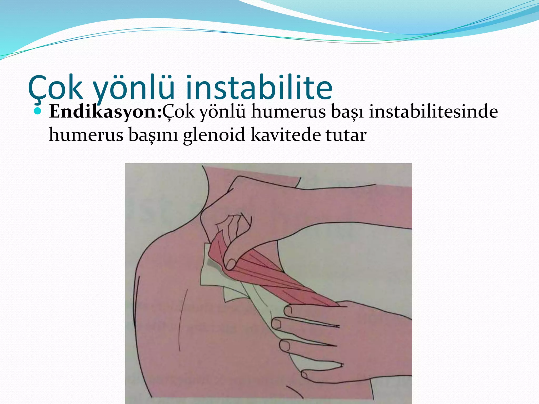 Çok yönlü instabilite 
 Endikasyon:Çok yönlü humerus başı instabilitesinde 
humerus başını glenoid kavitede tutar 
 
