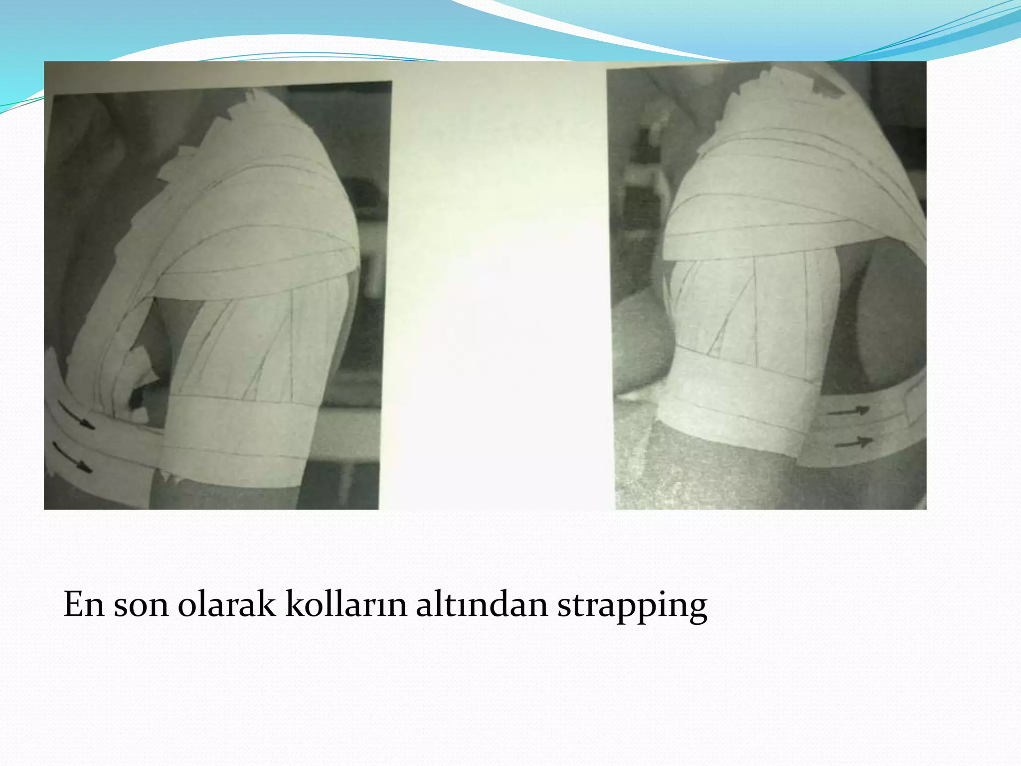En son olarak kolların altından strapping 
 
