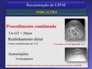 Objetivo da reconstrução
Restaurar tanto a anatomia quanto a
função
 