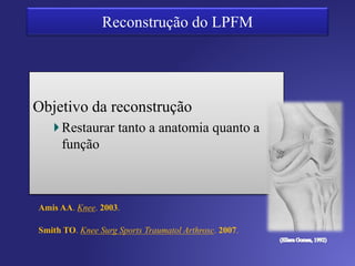 Erros de posicionamento e Tensionamento
5mm de mal posicionamento – proximal ou distal
3mm de encurtamento
Tensionamento > 2N 10 N
Aumento na pressão da faceta medial
 