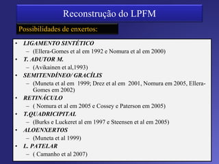 Tubérculo Adutor (TA)
Conlan et al, JBJS Am, 1993; Tuxoe et al, Knee, 2002
Epicôndilo medial
Warren e Marshal, JBJS Am, 1979; Reider et al, JBJS Am, 1981; Hughston et al, Saunders,
Philadelphia, 1984; Avikainen et al, Clin Orthop, 1993; Hautamaa et al, Clin Orthop, 1998)
Anterior ao epicôndilo medial
Feller et al, Knee, 1993
Póstero-superior ao epicôndilo medial e distal ao
TA
Nomura et al, Knee, 1992; 2005
Posterior ao epicôndilo medial e 1 cm distal ao TA
Smirk e Morris, Knee, 2003; Legrand et al, Sports Med, 2007
Inserção femoral
 